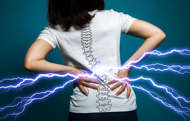 Đau lưng ở các mức độ khác nhau là triệu chứng gai cột sống thường gặp