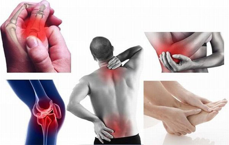 Đau xương khớp khi vận động có thể liên quan đến gân, cơ