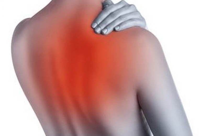 Có nhiều nguyên nhân gây đau lưng trên