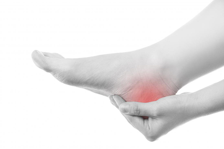 Bệnh gout đau gót chân ảnh hưởng lớn đến vận động, sinh hoạt
