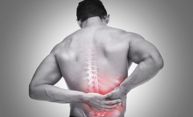 Thoát vị đĩa đệm là một trong những nguyên nhân gây đau lưng