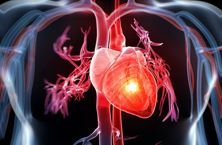 Bệnh viêm khớp có thể gây biến chứng tim mạch nguy hiểm